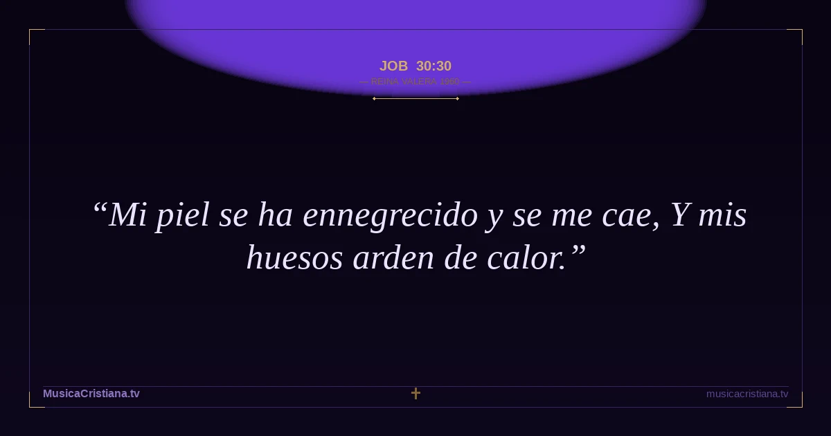 Job 30:30 — Biblia Reina Valera 1960 — MusicaCristiana.tv